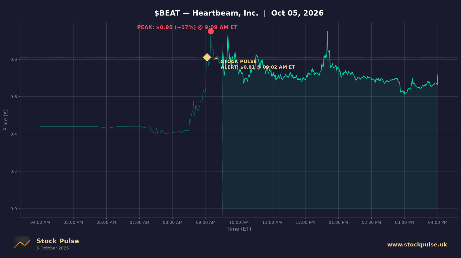 BEAT intraday chart, Oct 5, 2026