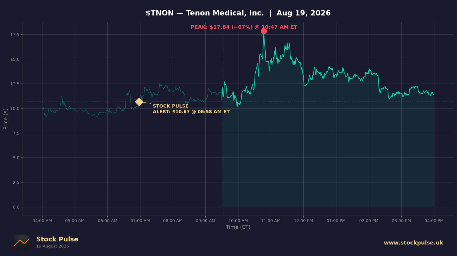 TNON intraday chart, Aug 19, 2026