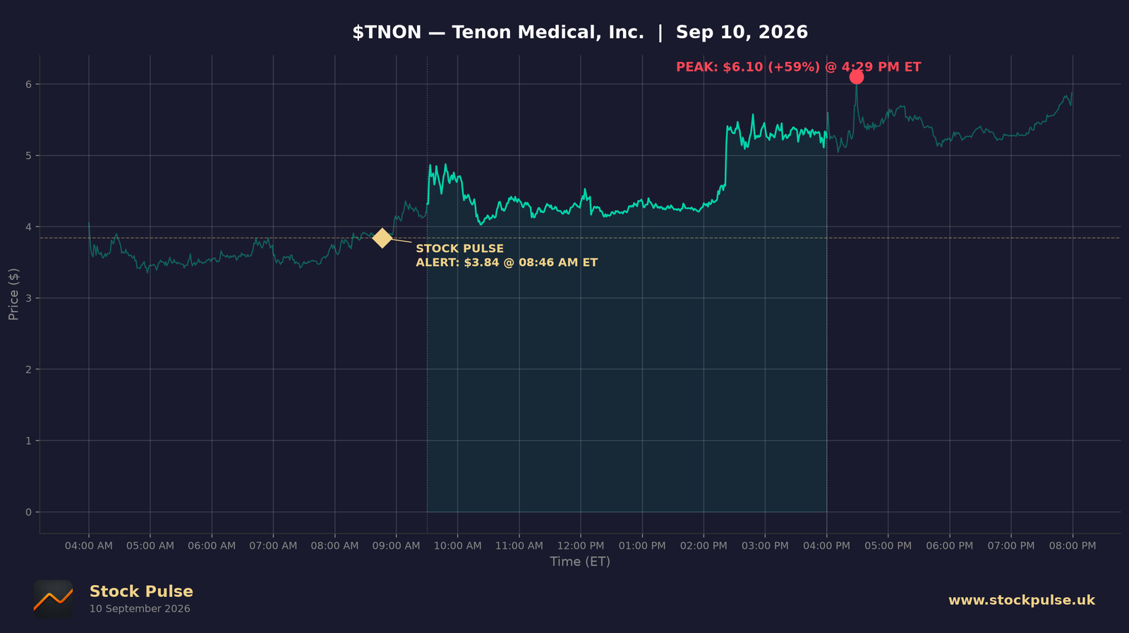 TNON intraday chart, Sep 10, 2026